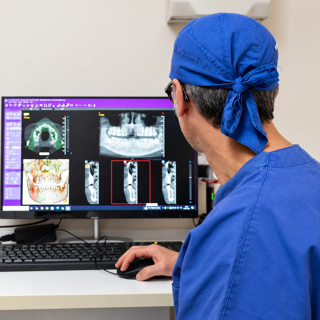 estrazione-dente-del-giudizio il dottor favro specialista in endodonzia a cuneo che controlla al pc le scansioni fatte al paziente