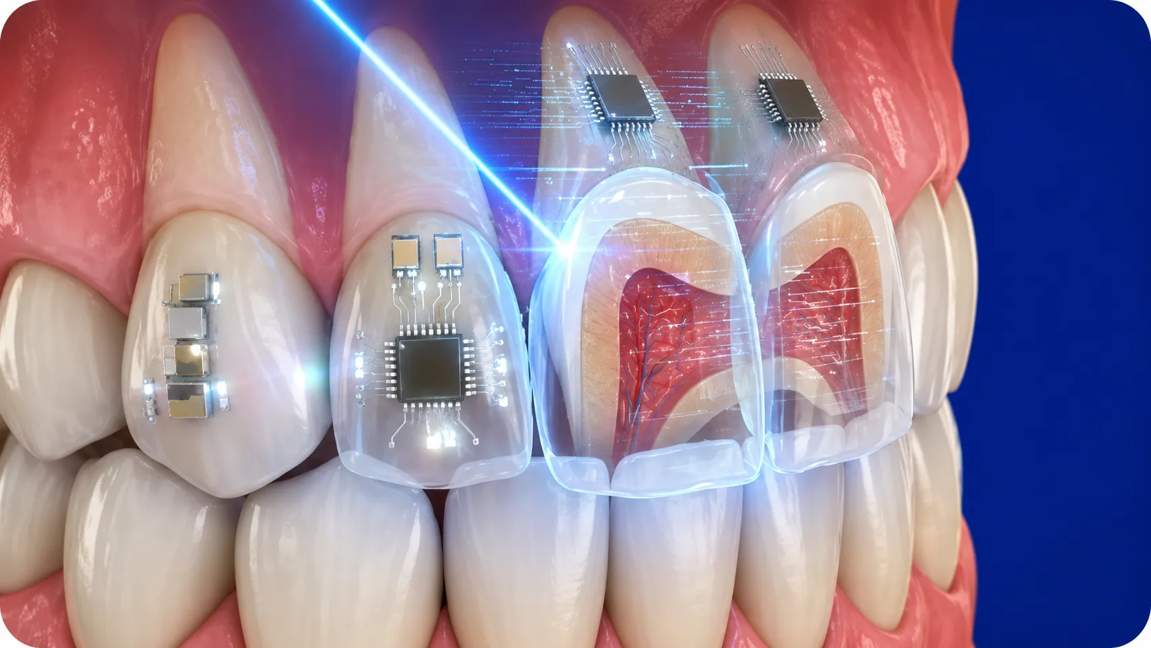 odontoiatria-digitale-tecnologie-studio-dentistico-favro-cuneo Denti anteriori rappresentati con elementi digitali e anatomici sovrapposti per raffigurare l'utilizzo delle tecnologie odontoiatriche