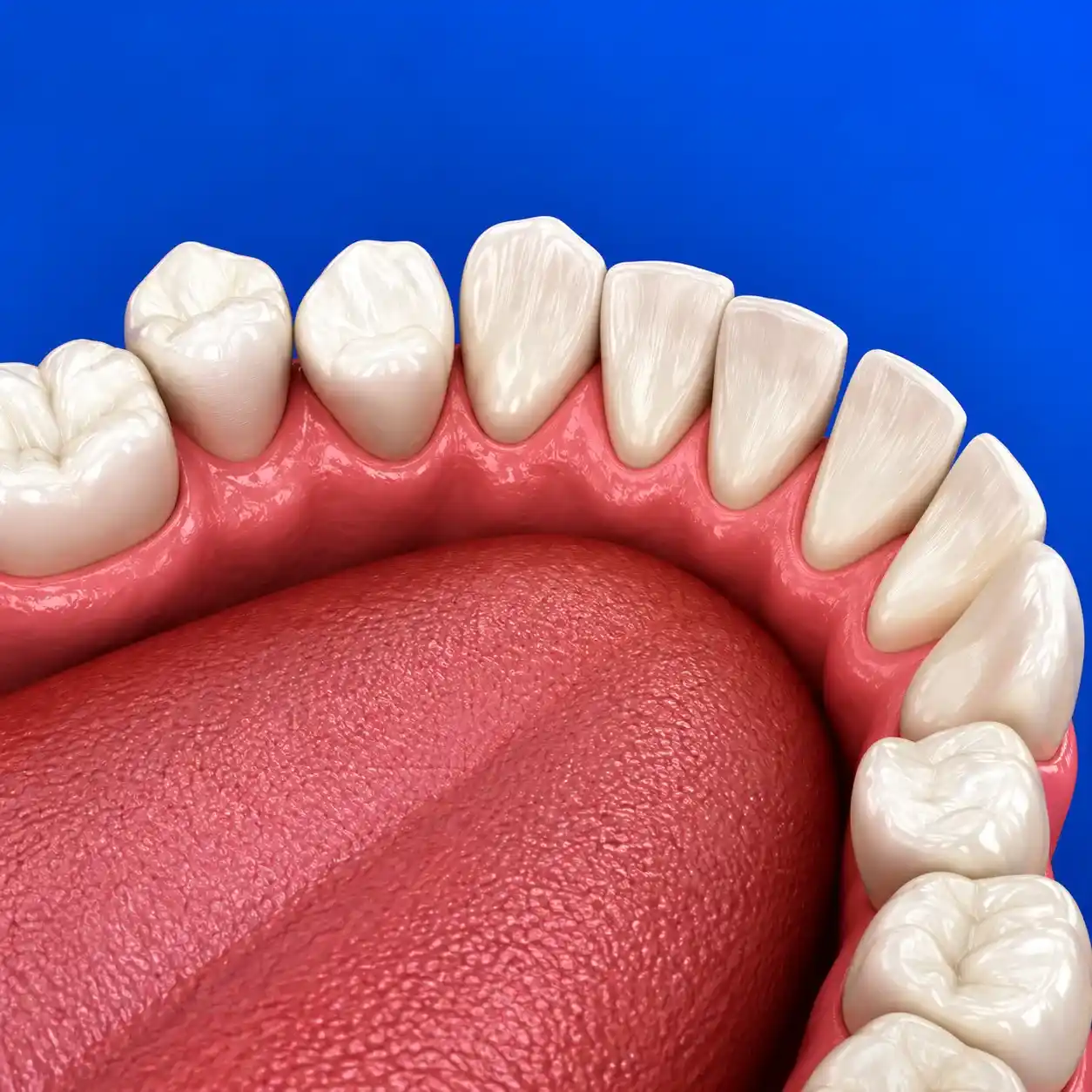 ortodonzia-cuneo illustrazione arcata inferiore con denti storti