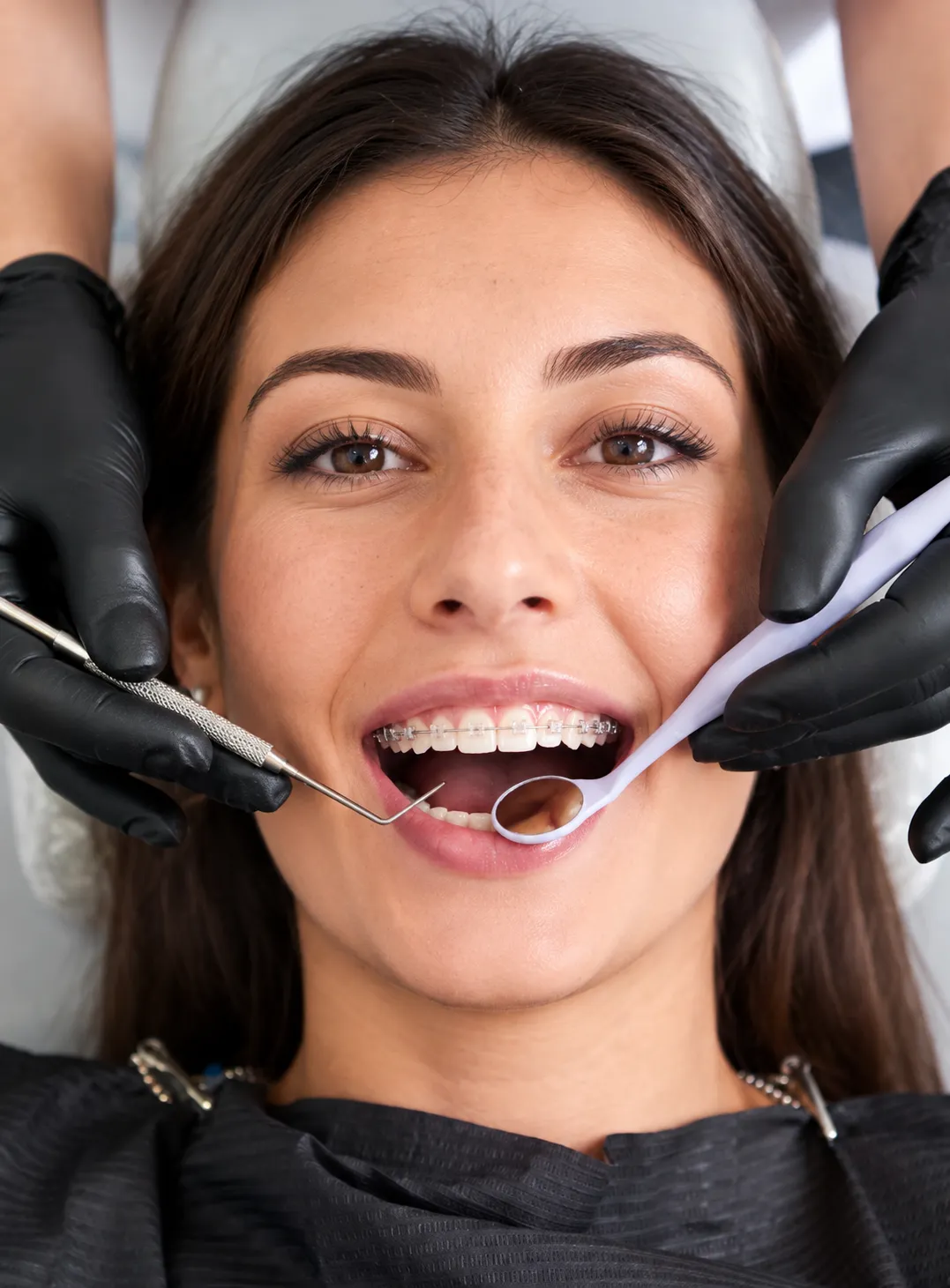 tipologie-di-apparecchio donna sorridente dal dentista che mostra il suo apparecchio fisso